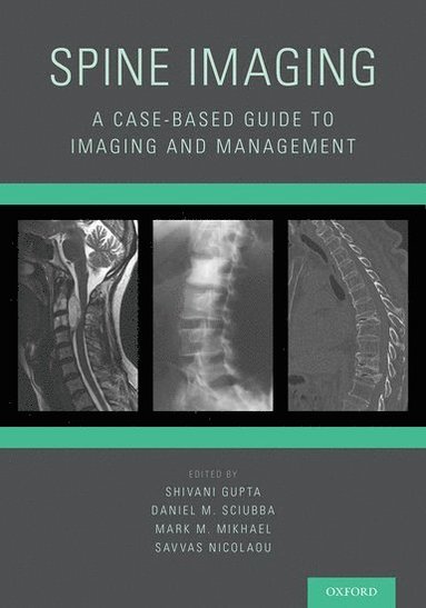 bokomslag Spine Imaging