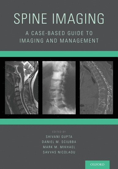 Shivani Gupta, Daniel M. Sciubba, Mark M. Mikhael, Savvas Nicolaou, Canada) Gupta, Shivani (MD, Clinical Instructor in Radiology, Diagnostic Neuroradiologist, MD, Clinical Instructor in Radiology, Diagnostic Neuroradiologist, University of British Columbia, Abbotsford Regional Hospital and Cancer Center, Fraser Health Authority, Abbotsford, BC, Johns Hopkins University Hospital) Sciubba, Daniel M. (Assistant Professor of Neurosurgery, Orthopaedic Surgery, and Oncology, Director, Minimally Invasive Spine Surgery, Assistant Professor of Neurosurgery, Orthopaedic Surgery, and Oncology, Director, Minimally Invasive Spine Surgery, USA) Mikhael, Mark M. (MD, Reconstructive Spine Surgeon, and Clinical Educator, MD, Reconstructive Spine Surgeon, and Clinical Educator, Illinois Bone and Joint Institute, Division of Spine Surgery, NorthShore University Health System, and Department of Orthopedic Surgery, Pritzker School of Medicine, University of Chicago, Chicago, Illinois, University of British Columbia; Vancouver General Hospital) Nicolaou, Savvas (Associate Professor of Radiology; Director of Emergency / Trauma Imaging, Associate Professor of Radiology; Director of Emergency / Trauma Imaging - Spine Imaging, Häftad