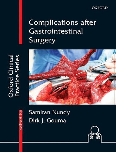 Samiran Nundy, Dirk J. Gouma, Samiran Nundy, Dirk J. Gouma - Complications after Gastrointestinal Surgery, Inbunden