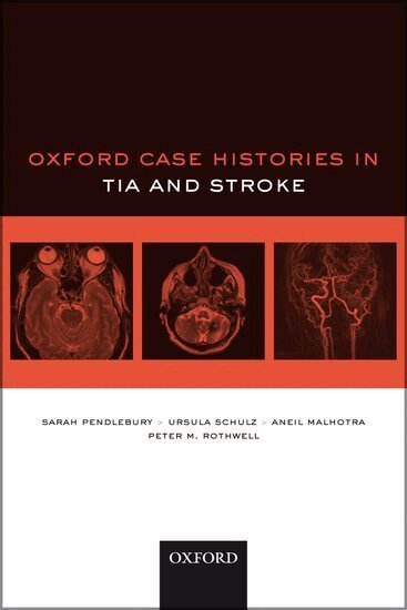 Sarah T. Pendlebury, Ursula G. Schulz, Aneil Malhotra, Peter M. Rothwell - Oxford Case Histories in TIA and Stroke, Häftad