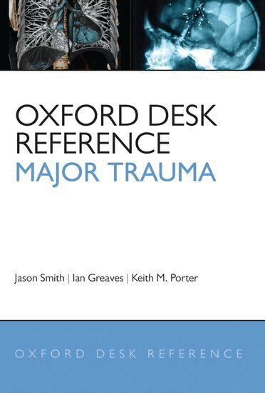 Jason Smith, Ian Greaves, Keith Porter - Oxford Desk Reference: Major Trauma, Inbunden
