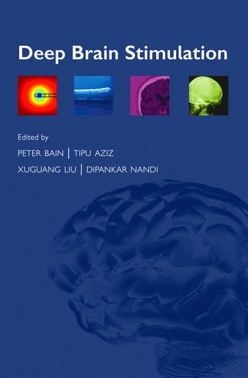 bokomslag Deep Brain Stimulation