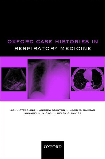 John Stradling, Andrew Stanton, Najib M. Rahman, Annabel H. Nickol, Helen E. Davies - Oxford Case Histories in Respiratory Medicine, Häftad