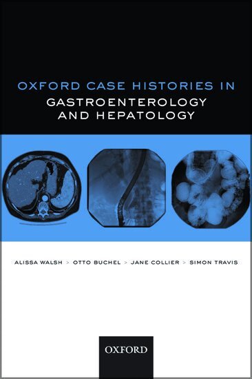 Alissa J. Walsh, Otto C. Buchel, Jane Collier, Simon P.L. Travis - Oxford Case Histories in Gastroenterology and Hepatology, Häftad