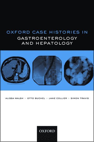 Oxford Case Histories in Gastroenterology and Hepatology 1