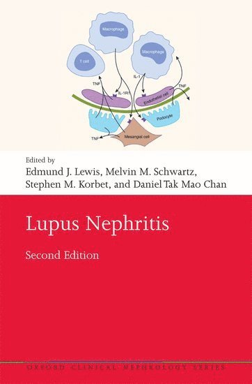 bokomslag Lupus Nephritis