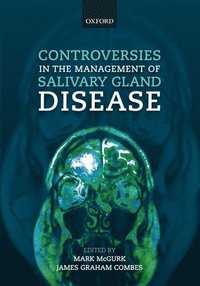 bokomslag Controversies in the Management of Salivary Gland Disease