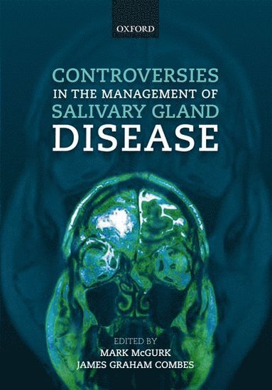 bokomslag Controversies in the Management of Salivary Gland Disease