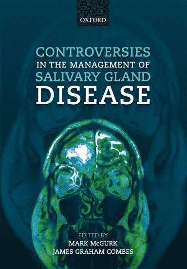 Controversies in the Management of Salivary Gland Disease 1