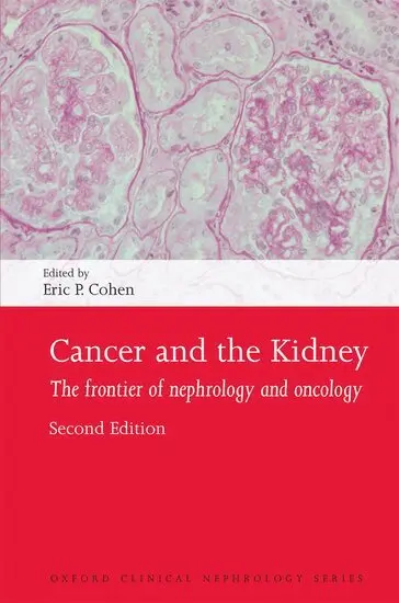 Eric P. Cohen - Cancer and the Kidney, Häftad