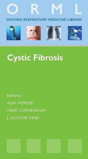 bokomslag Cystic Fibrosis