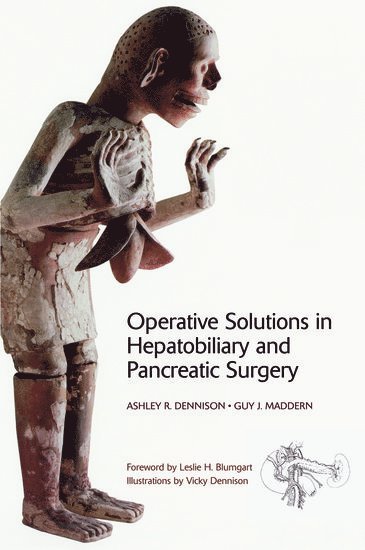 Operative Solutions in Hepatobiliary and Pancreatic Surgery 1