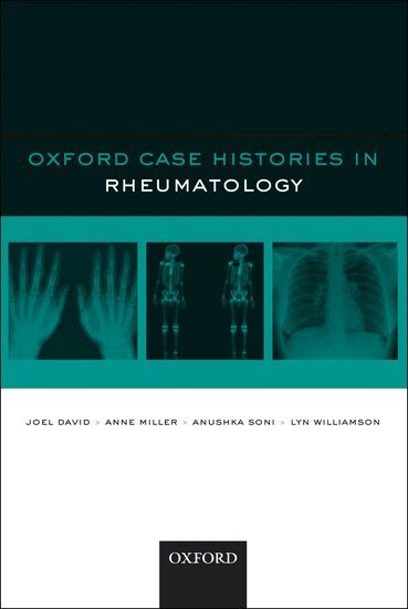 Joel David, Anne Miller, Anushka Soni, Lyn Williamson - Oxford Case Histories in Rheumatology, Häftad