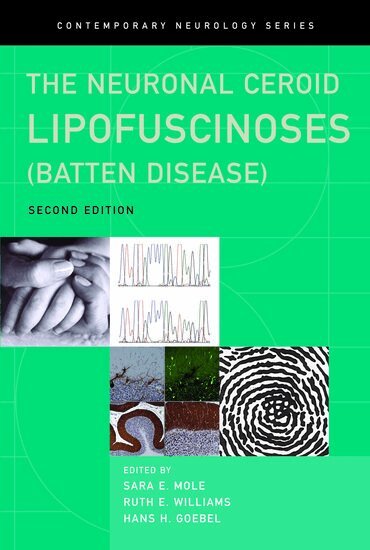 Sara Mole, Ruth Williams, Hans Goebel - The Neuronal Ceroid Lipofuscinoses (Batten Disease), Inbunden