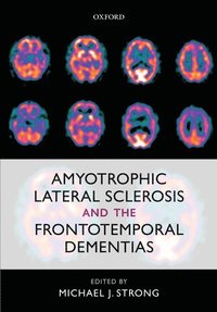 bokomslag Amyotrophic Lateral Sclerosis and the Frontotemporal Dementias