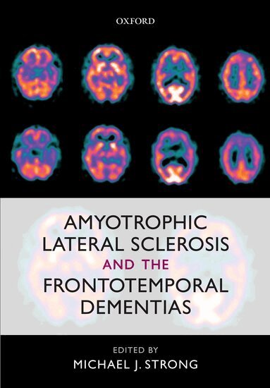 Michael J. Strong - Amyotrophic Lateral Sclerosis and the Frontotemporal Dementias, Inbunden