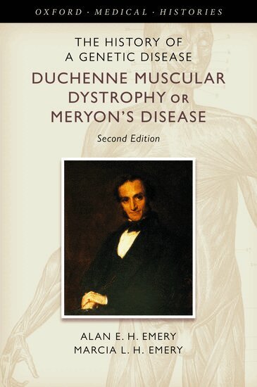 Alan E. H. Emery, Marcia L. H. Emery - The History of a Genetic Disease, Inbunden
