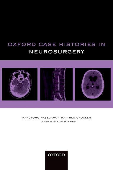 Harutomo Hasegawa, Matthew Crocker, Pawan Singh Minhas - Oxford Case Histories in Neurosurgery, Häftad