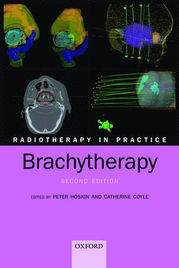 Radiotherapy in Practice - Brachytherapy 1