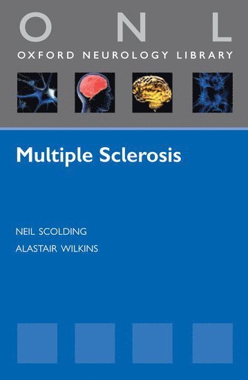 bokomslag Multiple Sclerosis