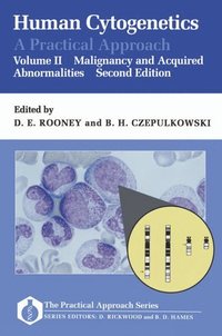 bokomslag Human Cytogenetics: A Practical Approach: Volume II: Malignancy and Acquired Abnormalities