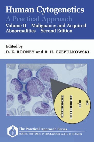 Rooney, Czepulkowski - Human Cytogenetics: A Practical Approach: Volume II: Malignancy and Acquired Abnormalities, Häftad