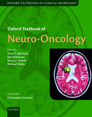 Tracy Batchelor, Ryo Nishikawa, Nancy Tarbell, Michael Weller - Oxford Textbook of Neuro-Oncology, Inbunden