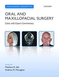 bokomslag Challenging Concepts in Oral and Maxillofacial Surgery