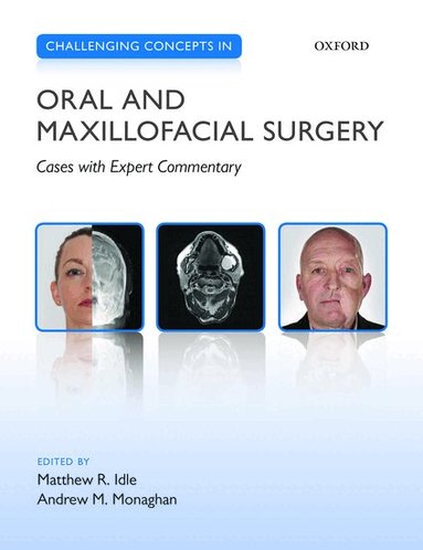 Matthew R. Idle, Andrew M. Monaghan - Challenging Concepts in Oral and Maxillofacial Surgery, Häftad