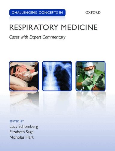 Lucy Schomberg, Elizabeth Sage, Nicholas Hart - Challenging Concepts in Respiratory Medicine, Häftad
