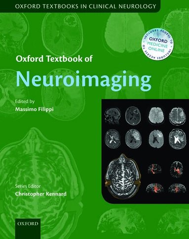 Filippi, Massimo Filippi - Oxford Textbook of Neuroimaging, Inbunden