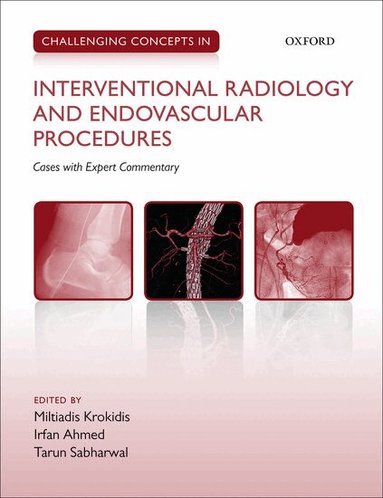 Miltiadis Krokidis, Irfan Ahmed, Tarun Sabharwal - Challenging Concepts in Interventional Radiology, Häftad