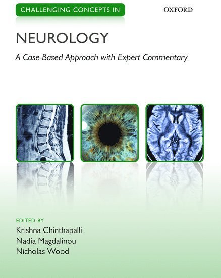 Krishna Chinthapalli, Nadia Magdalinou, Nicholas Wood - Challenging Concepts in Neurology: Cases with Expert Commentary, Häftad