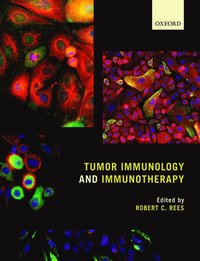 bokomslag Tumor Immunology and Immunotherapy