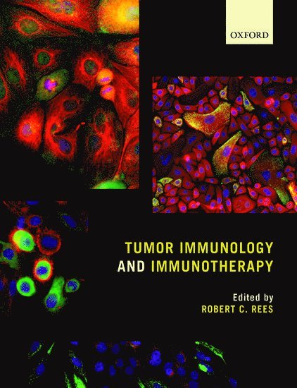 Tumor Immunology and Immunotherapy 1