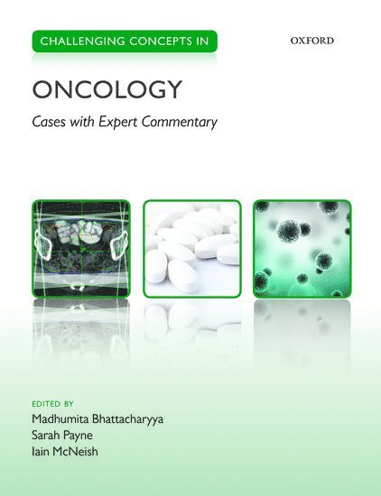 Challenging Concepts in Oncology 1