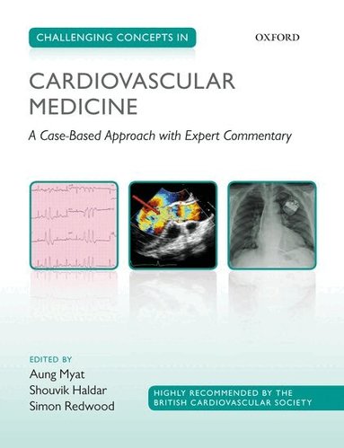 Aung Myat, Shouvik Haldar, Simon Redwood - Challenging Concepts in Cardiovascular Medicine, Häftad