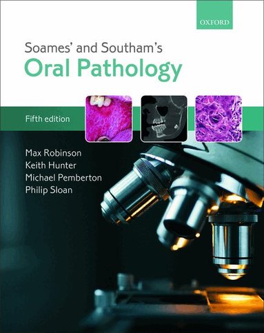 Max Robinson, Keith Hunter, Michael Pemberton, Philip Sloan - Soames' & Southam's Oral Pathology, Häftad
