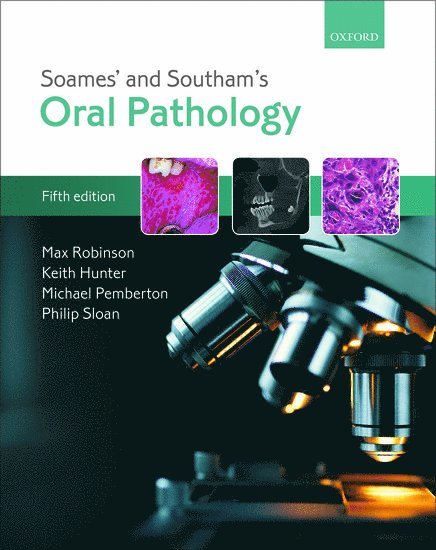 Soames' & Southam's Oral Pathology 1