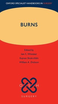 bokomslag Burns