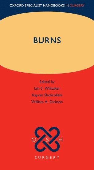 bokomslag Burns