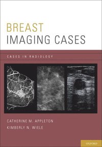 bokomslag Breast Imaging Cases