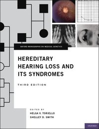 bokomslag Hereditary Hearing Loss and Its Syndromes