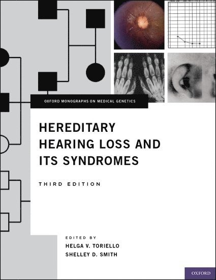 Hereditary Hearing Loss and Its Syndromes 1
