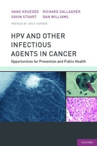 bokomslag HPV and Other Infectious Agents in Cancer