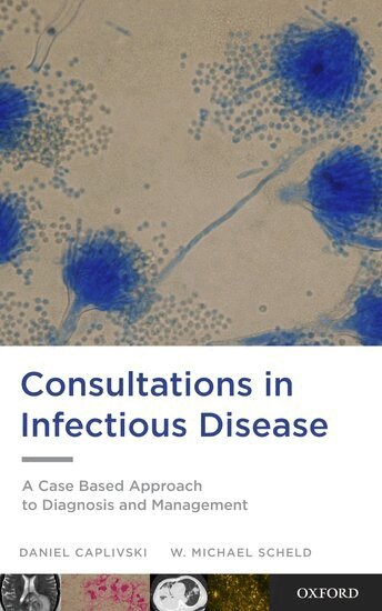Daniel Caplivski, W. Michael Scheld - Consultations in Infectious Disease, Häftad