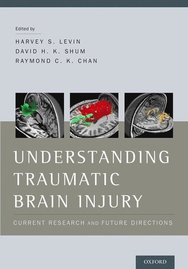bokomslag Understanding Traumatic Brain Injury