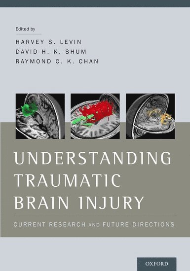 Understanding Traumatic Brain Injury 1