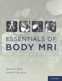 bokomslag Essentials of Body MRI