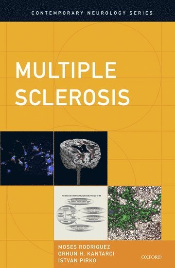 bokomslag Multiple Sclerosis